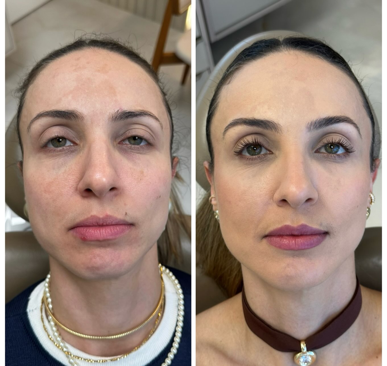 Caso 1, registro 1 da publicação original de antes e depois