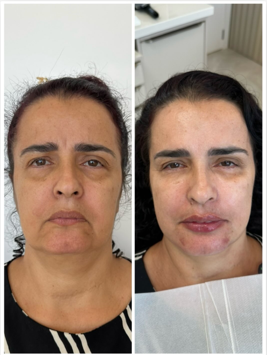 Caso 2, registro 1 da publicação original de antes e depois