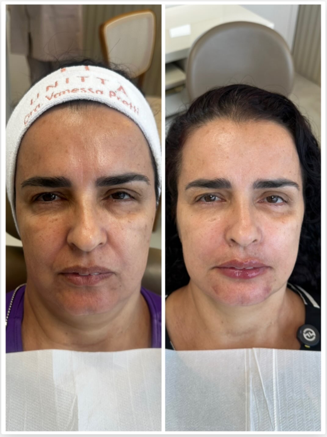 Caso 2, registro 2 da publicação original de antes e depois