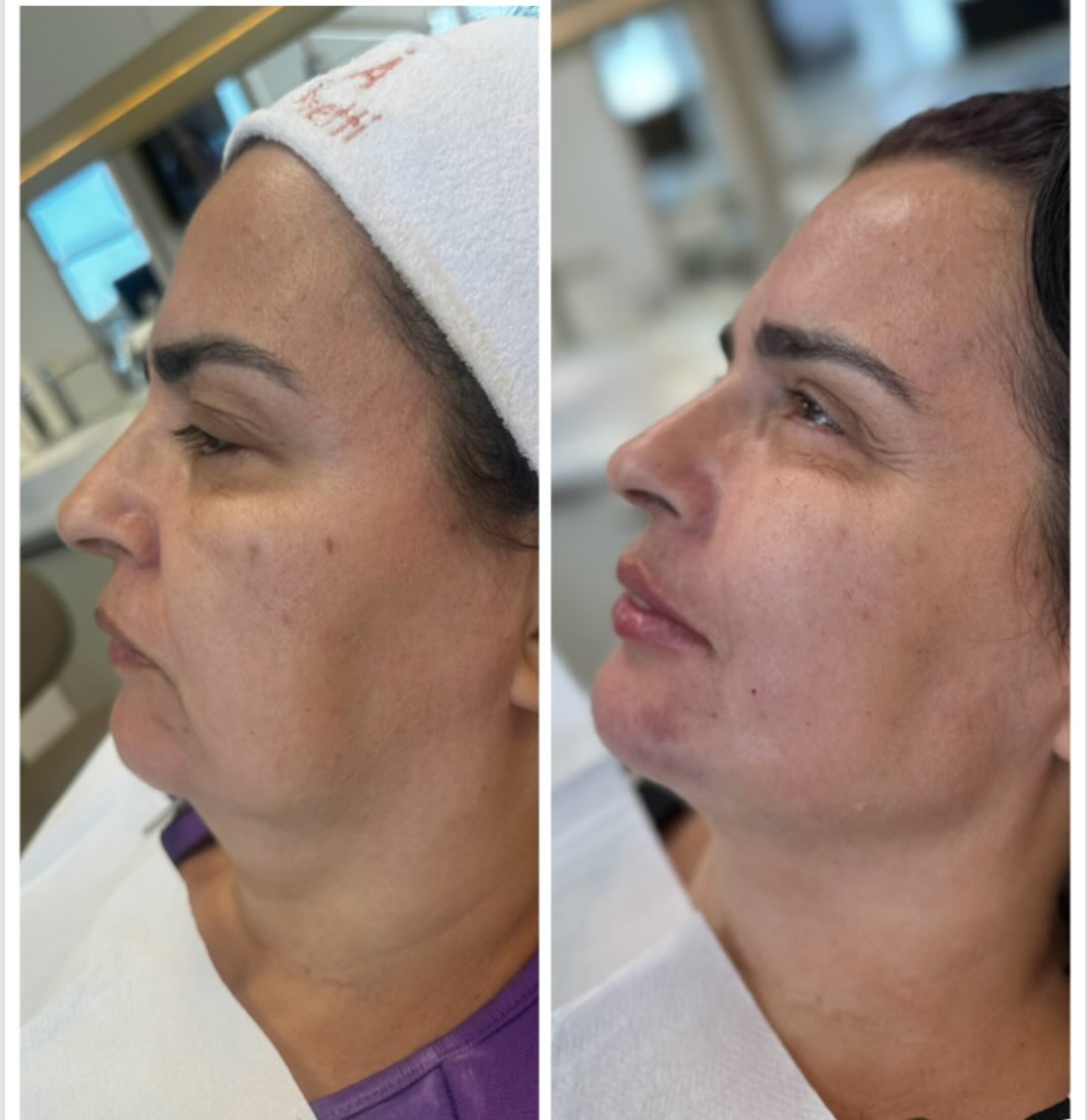 Caso 2, registro 3 da publicação original de antes e depois