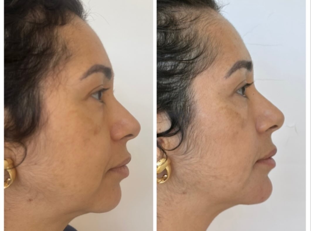 Caso 5, foto 4 da publicação da Dra. Vanessa