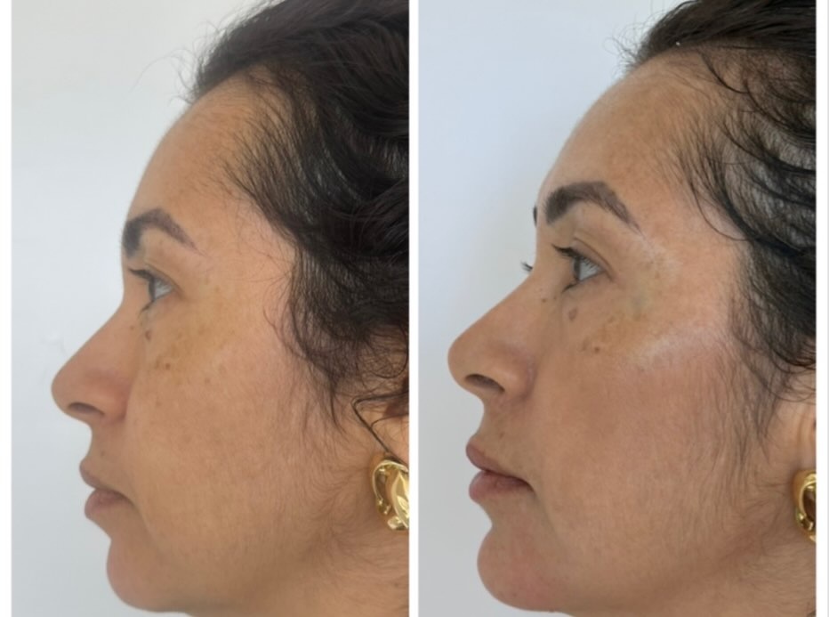 Caso 5, foto 5 da publicação da Dra. Vanessa
