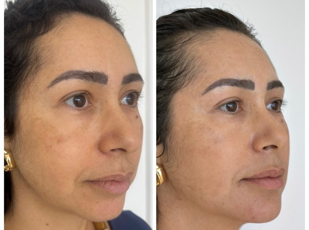 Caso 5, foto 6 da publicação da Dra. Vanessa